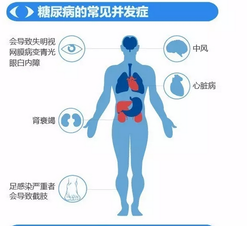 你造嗎？糖尿病晚期眼睛會致盲！